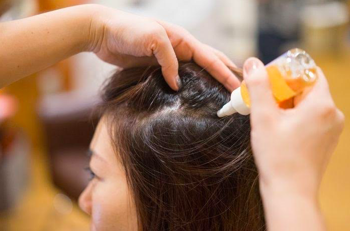 Rambutmu Tipis dan Sering Rontok? Atasi dengan 3 Hair... - Ge...